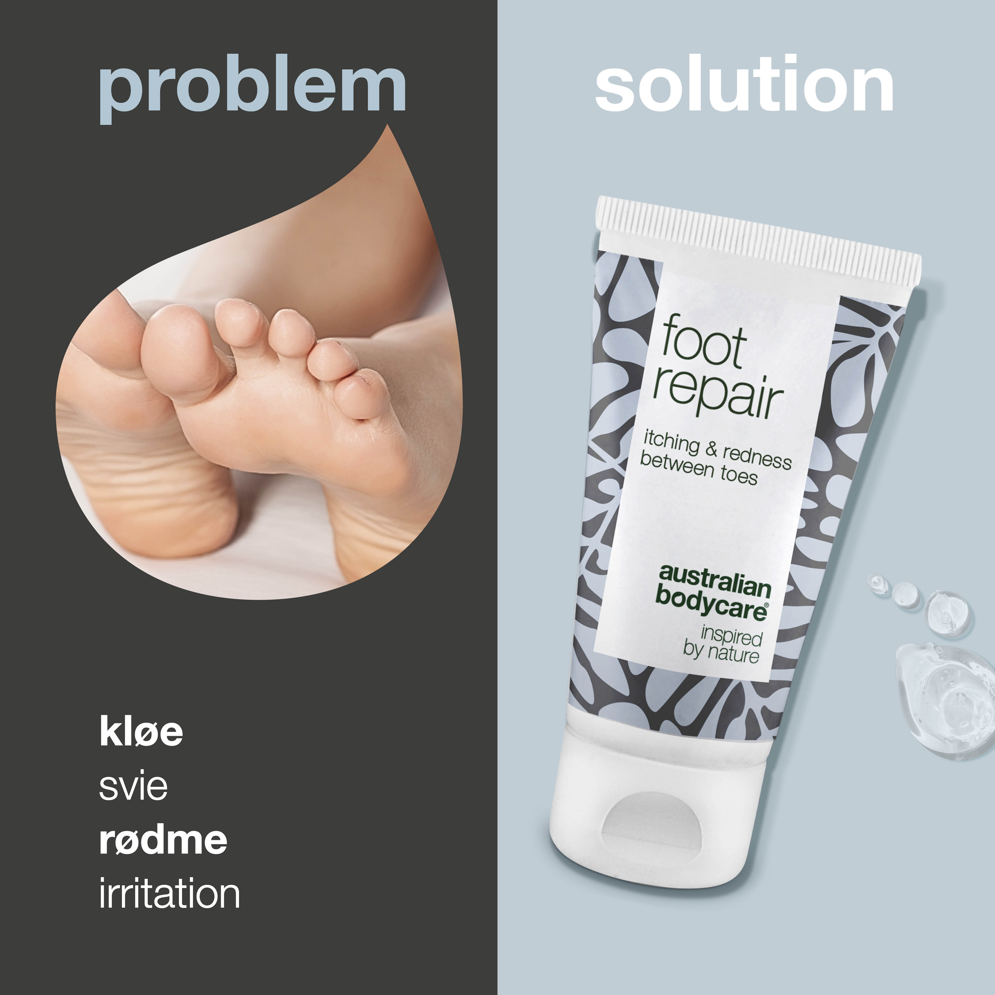 Fodgel med Tea Tree Oil — Lindrende gel mod kløe, svie og rødme mellem tæerne.