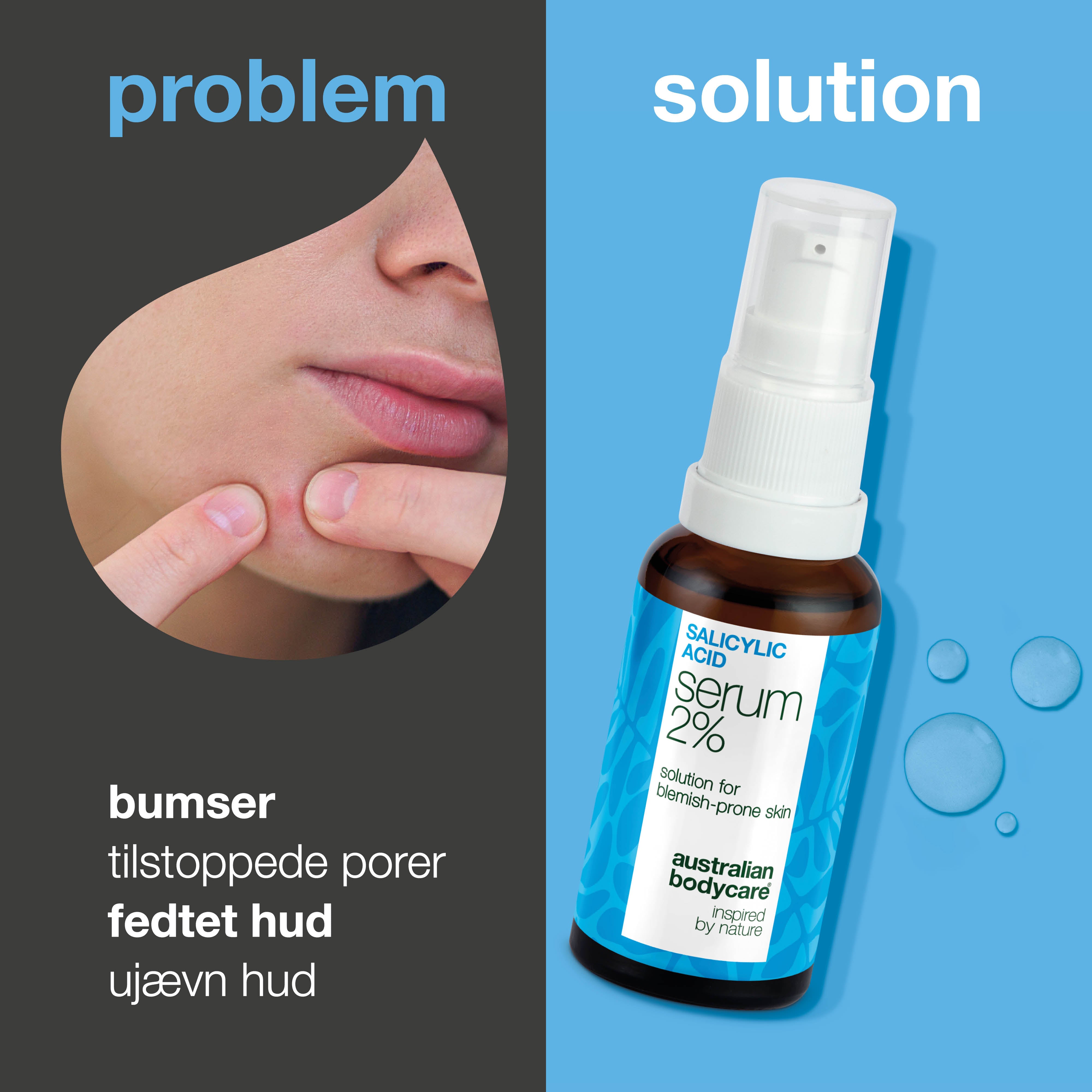 Serum mod bumser, hudorme og uren hud – Salicylsyre 2 % — Serum mod bumser og fedtet hud. Renser porer og dæmper udbrud. Med salicylsyre 2 %, Zinc PCA, grøn te og hyaluronsyre.