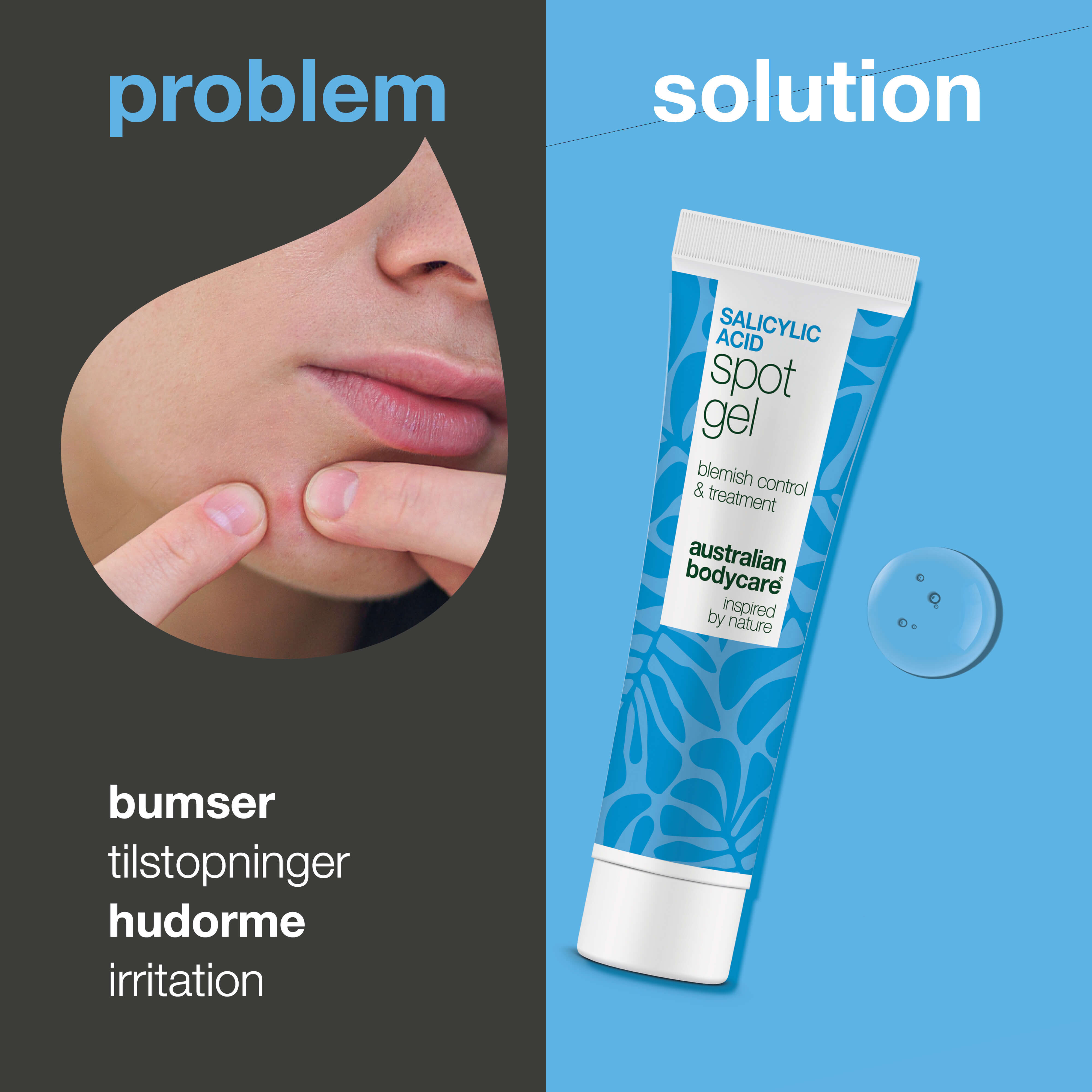 Salicylsyre Spot Gel mod bumser, hudorme og rødme — Salicylsyre Spot Gel til uren hud. Reducerer rødme og tilstopninger med effektiv salicylsyre for en klarere hud.