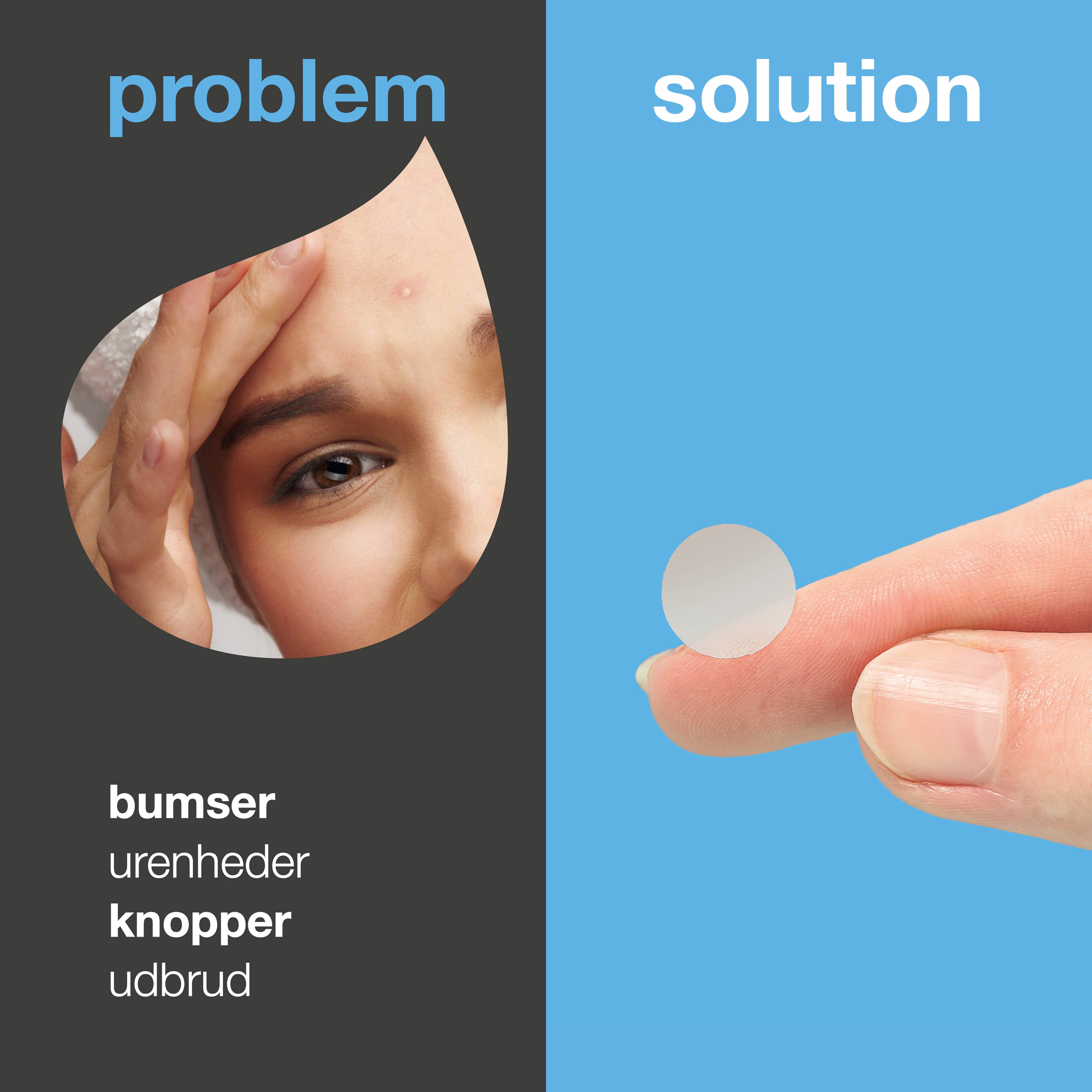 Salicylsyre Pimple Patches mod bumser og fedtet hud — Salicylsyre Pimple Patches mod bumser og hudorme. Med salicylsyre, grøn te og hyaluronsyre for rolig og ren hud.