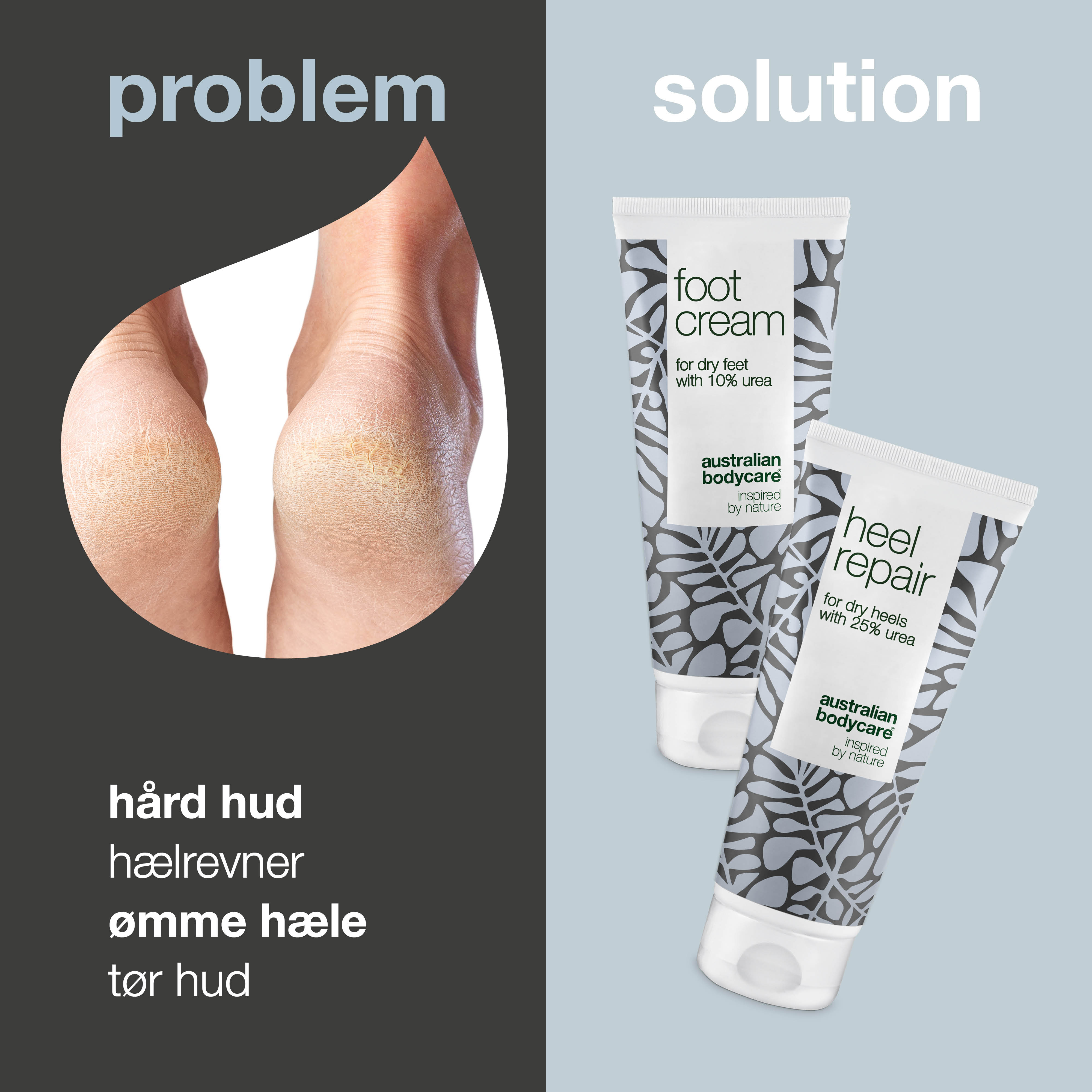 Pakke til hård hud på hælen og fødderne — Sådan fjerner du hård hud på hælen og fødderne med denne fodcreme og hælcreme med Urea