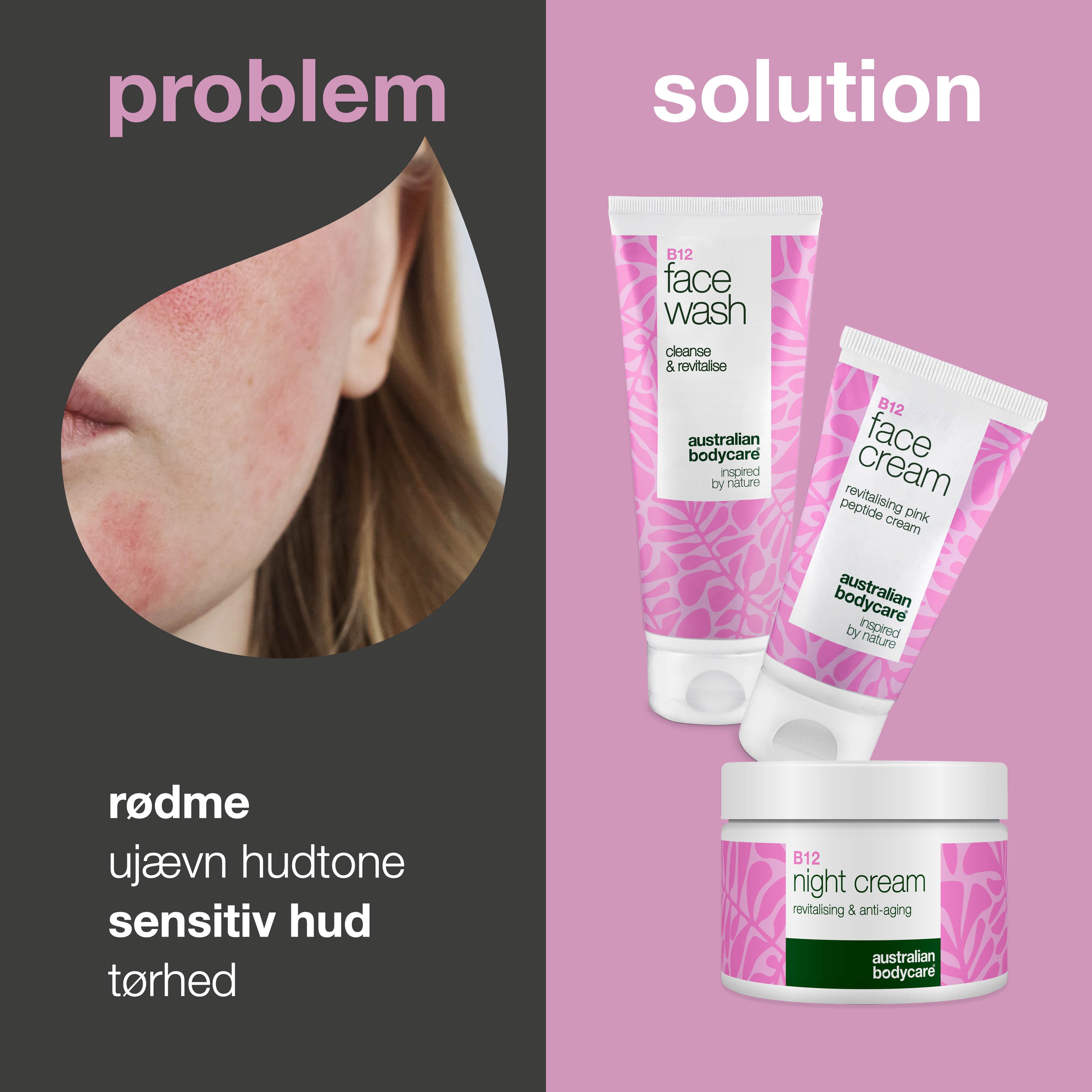 B12 Hudplejesæt mod rødme – Ansigtsrens, dag- og natcreme — B12 hudpleje til rødme og tendens til rosacea. Rens, dagcreme og natcreme der beroliger og fugter.