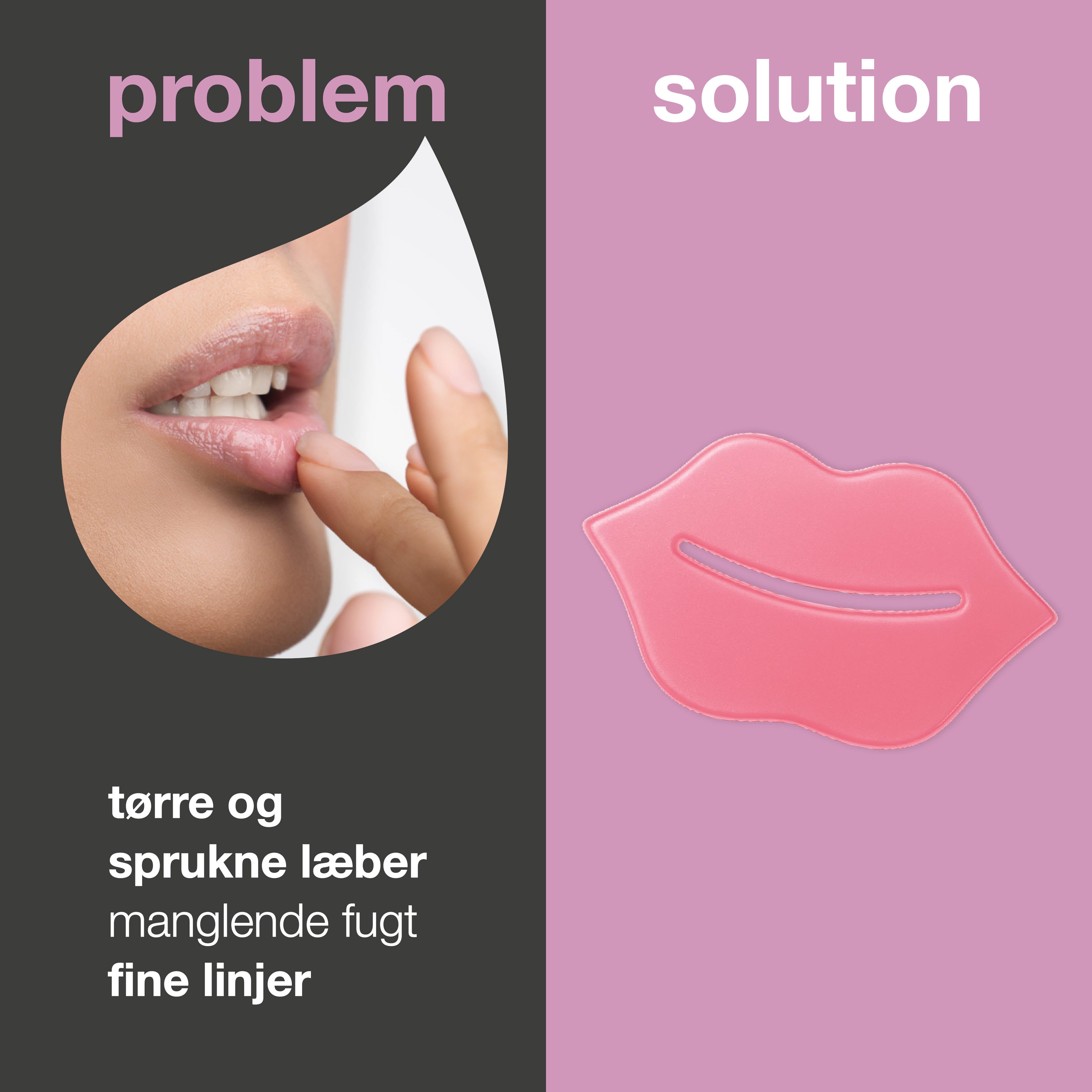 Læbemaske mod tørre læber og fine linjer – med B12 — Læbemaske mod tørhed og linjer. Giver fugt og fylde til læberne. Med B12-vitamin, kollagen og hyaluronsyre.