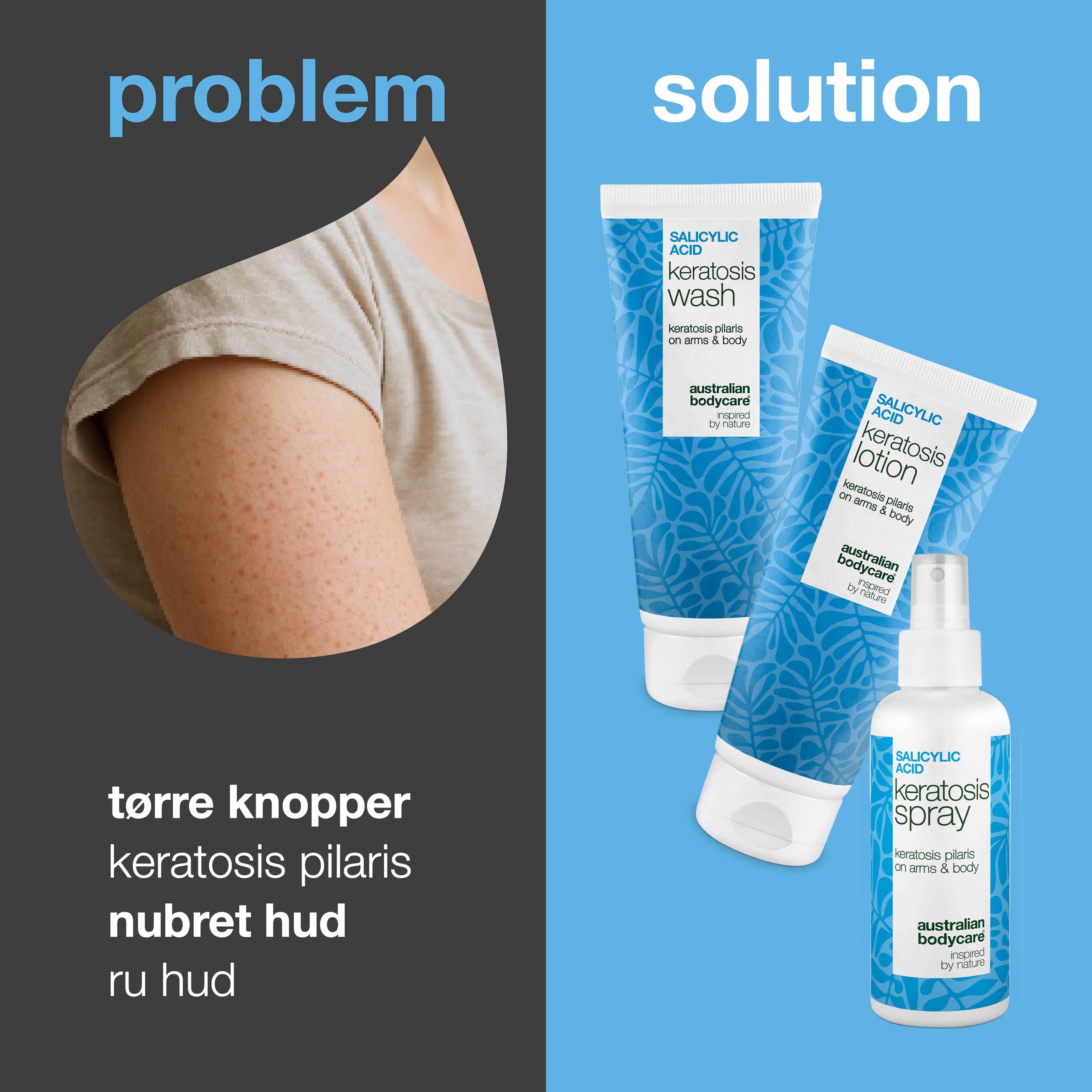 Pakke mod Keratosis Pilaris – Glatter ru og tør hud — Pakke mod Keratosis Pilaris udjævner røde knopper og ru hud. Gør huden blød og glat på arme, lår og baller.